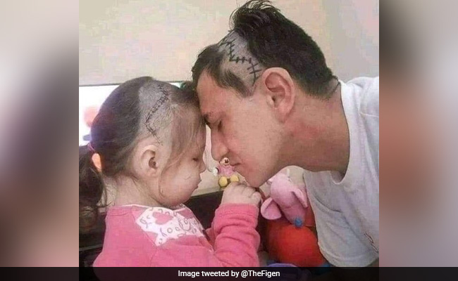 बेटी की ब्रेन सर्जरी होने पर पिता ने किया दिल जीतने वाला काम, वायरल फोटो देख हर कोई हुआ भावुक