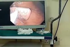 तलाशी के डर से तिहाड़ जेल के कैदी ने मोबाइल फोन निगला तलाशी के डर से तिहाड़ जेल के कैदी ने मोबाइल फोन निगला