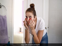 आंखों के नीचे होने वाले Dark Circles से हैं परेशान, तो अपनाइए ये 10 घरेलू नुस्खे, झटपट हो जाएंगे दूर आंखों के नीचे होने वाले Dark Circles से हैं परेशान, तो अपनाइए ये 10 घरेलू नुस्खे, झटपट हो जाएंगे दूर