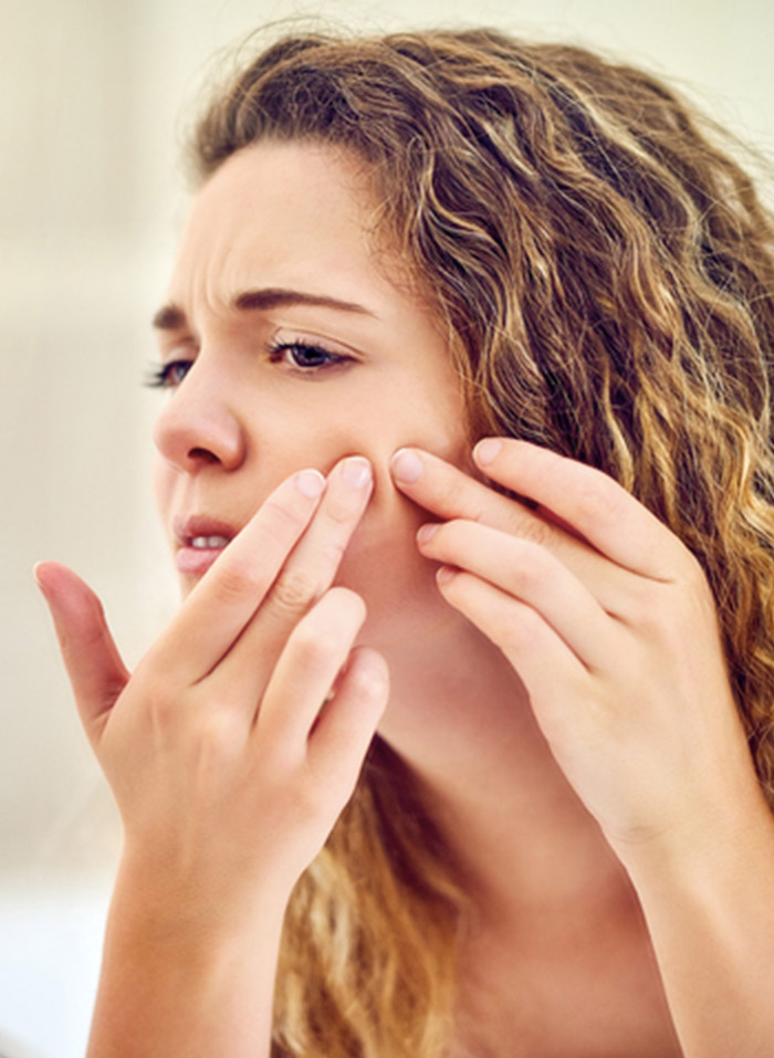 There are many different types of acne, and knowing which one you have is crucial in treating it
