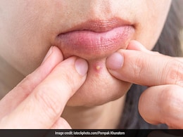 चेहरे के घाव को भरने में और तनाव कम करने में नंबर वन पर आता है ये फल, करिए डाइट में शामिल चेहरे के घाव को भरने में और तनाव कम करने में नंबर वन पर आता है ये फल, करिए डाइट में शामिल