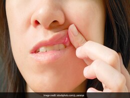 Home Remedies: मुंह के छालों से परेशान हैं तो इन 6 चीजों को खा कर पा सकते हैं आराम, जल्द ही देखिए आजमाकर Home Remedies: मुंह के छालों से परेशान हैं तो इन 6 चीजों को खा कर पा सकते हैं आराम, जल्द ही देखिए आजमाकर