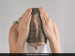 Hair Care Tips: ड्रीम हेयर पाने के लिए क्यों जरूरी है बायोटिन? कहां से करें Biotin की कमी पूरी, जानें डेली कितना लें Hair Care Tips: ड्रीम हेयर पाने के लिए क्यों जरूरी है बायोटिन? कहां से करें Biotin की कमी पूरी, जानें डेली कितना लें