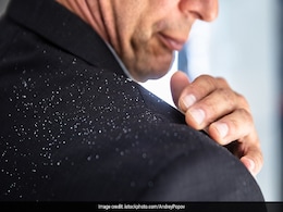 सिर पर जमे डैंड्रफ को दूर कर सकती हैं घर की ये 5 चीजें, घी भी आता है काम Dandruff भगाने में सिर पर जमे डैंड्रफ को दूर कर सकती हैं घर की ये 5 चीजें, घी भी आता है काम Dandruff भगाने में