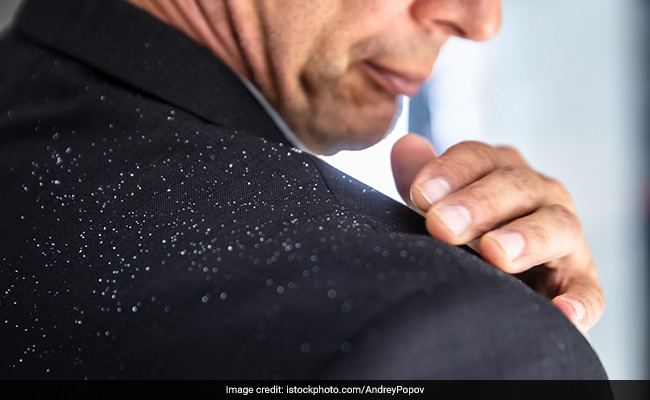 Dandruff may be a result of dry scalp in winter