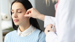 Are Pimple Patches A Safer Way To Treat Active Acne?