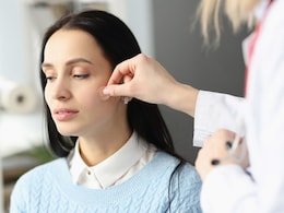 Are Pimple Patches A Safer Way To Treat Active Acne? Are Pimple Patches A Safer Way To Treat Active Acne?