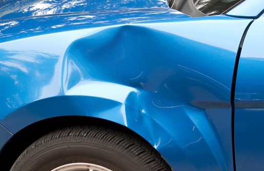 Dented Your Car? Don't Panic And Try One of These Eight Things Instead