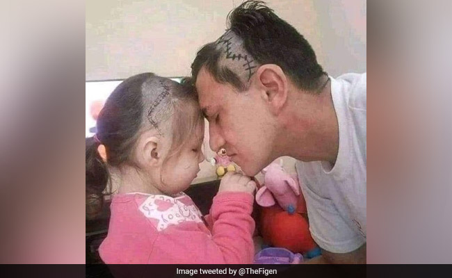 बेटी के दिमाग का हुआ ऑपरेशन फिर पिता ने वो कर दिया जो कोई सोच नहीं सकता था