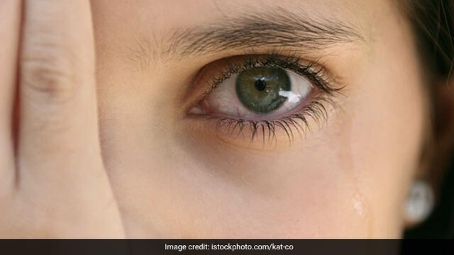 A diet rich in antioxidants is recommended to slow down progression of AMD