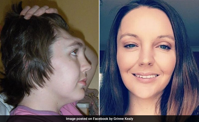 कार हादसे में महिला को खोना पड़ा था माथा, मगर डॉक्टर्स ने चमत्कार कर दिखाया