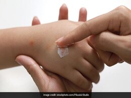 Home Remedies: कीड़ा काट जाए तो जल्द अपनाएं ये घरेलू उपाय, जलन और सूजन की नहीं आएगी नौबत Home Remedies: कीड़ा काट जाए तो जल्द अपनाएं ये घरेलू उपाय, जलन और सूजन की नहीं आएगी नौबत