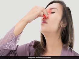 Dry Nose से बचने के लिए इन Oil का करें इस्तेमाल, झट से मिलेगा आराम Dry Nose से बचने के लिए इन Oil का करें इस्तेमाल, झट से मिलेगा आराम