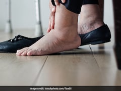 Swelling In These Body Parts Can Be A Sign Of Kidney Disease