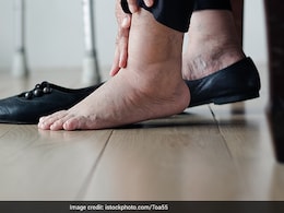 Swelling In These Body Parts Can Be A Sign Of Kidney Disease