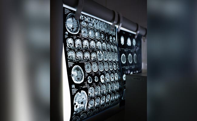 Scientists Develop AI-Powered Non-Invasive Tool That Can Read Your Mind