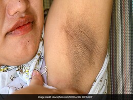 Dark underarms को चमकाने की आसान Home Remedy, नींबू में मिलाकर लगाएं हल्दी, जानें और भी गजब तरीके Dark underarms को चमकाने की आसान Home Remedy, नींबू में मिलाकर लगाएं हल्दी, जानें और भी गजब तरीके
