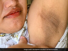 अंडरआर्म्स का कालापन दूर कर सकती है शैंपू की यह एक ट्रिक, बस बनाकर लगा लें यह पेस्ट अंडरआर्म्स का कालापन दूर कर सकती है शैंपू की यह एक ट्रिक, बस बनाकर लगा लें यह पेस्ट