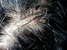 White Hair: रसोई की इस एक चीज से काले हो जाते हैं सफेद बाल, इस्तेमाल करना भी है बेहद आसान  White Hair: रसोई की इस एक चीज से काले हो जाते हैं सफेद बाल, इस्तेमाल करना भी है बेहद आसान