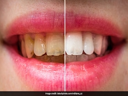 Oral Health: दांतों को साफ और स्वस्थ रखती हैं ये 2 खाने की चीजें, आज से ही शुरू कर दें इनका सेवन  Oral Health: दांतों को साफ और स्वस्थ रखती हैं ये 2 खाने की चीजें, आज से ही शुरू कर दें इनका सेवन