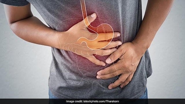 Incorporating these foods into your diet can help manage acid reflux naturally
