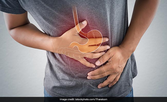 Incorporating these foods into your diet can help manage acid reflux naturally