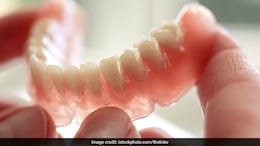 Delhi Doctors Remove Denture From Man's Food Pipe