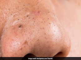 Skin Care: ब्लैकहेड्स से निजात पाना चाहते हैं तो इन घरेलू उपायों को आज से ही अपनाएं, कुछ ही दिनों में दिखेगा असर Skin Care: ब्लैकहेड्स से निजात पाना चाहते हैं तो इन घरेलू उपायों को आज से ही अपनाएं, कुछ ही दिनों में दिखेगा असर