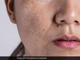 रात को सोने से पहले चेहरे पर लगा लें ये तेल, सुबह दाग-धब्बे हो जाएंगे गायब, मिलेगी चमकदार स्किन रात को सोने से पहले चेहरे पर लगा लें ये तेल, सुबह दाग-धब्बे हो जाएंगे गायब, मिलेगी चमकदार स्किन