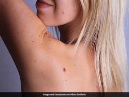 Mole removal home remedies : तिल हटाना चाहते हैं, तो इन घरेलू उपाय को आजमा सकते हैं, ये दादी के बताएं नुस्खे हैं, जो हैं बेहद कारगर Mole removal home remedies : तिल हटाना चाहते हैं, तो इन घरेलू उपाय को आजमा सकते हैं, ये दादी के बताएं नुस्खे हैं, जो हैं बेहद कारगर