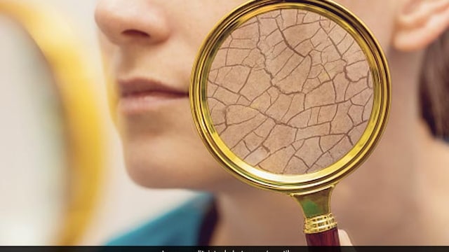 Skincare Tips: Lack of humidity in winters can dry your skin out