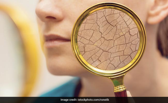 Skincare Tips: Lack of humidity in winters can dry your skin out