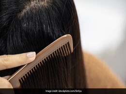 Oily Scalp से हैं परेशान तो अपनाकर देखें ये 5 घरेलू उपाय, सिर से तेल की परत चुटकियों में हो जाएगी गायब Oily Scalp से हैं परेशान तो अपनाकर देखें ये 5 घरेलू उपाय, सिर से तेल की परत चुटकियों में हो जाएगी गायब