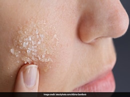 Natural Scrub: चेहरे से डेड स्किन हटाने में रसोई की ये 5 चीजें करेंगी मदद, आज ही कर सकते हैं इस्तेमाल  Natural Scrub: चेहरे से डेड स्किन हटाने में रसोई की ये 5 चीजें करेंगी मदद, आज ही कर सकते हैं इस्तेमाल