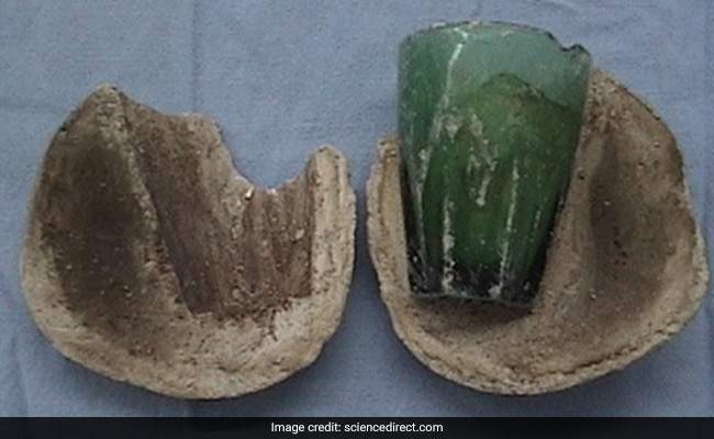 Woman Complains Of UTI, Scan Reveals Glass Tumbler In Bladder