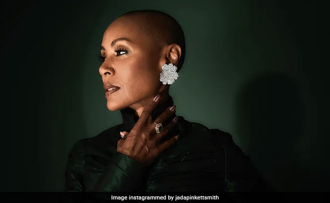 Will Smith's Wife Jada Has This Condition: All About Alopecia Areata