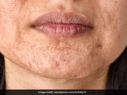 यह सफेद चीज दादी-नानी के जमाने से झाइयां और काले अंडरआर्म्स को ठीक करने में है कारगर, एक्सपर्ट मानसी गुलाटी से जान लें लगाने का सही तरीका यह सफेद चीज दादी-नानी के जमाने से झाइयां और काले अंडरआर्म्स को ठीक करने में है कारगर, एक्सपर्ट मानसी गुलाटी से जान लें लगाने का सही तरीका