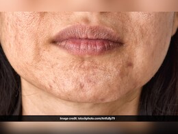 झुर्रिंयो से पूरा चेहरा भर गया है तो ये 4 जूस पीना शुरू कर दें, एकदम साफ हो जाएगा फेस, ग्लो दिखने लगेगा