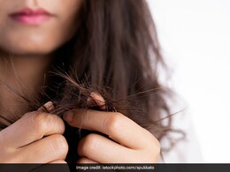 नारियल तेल में मिलाकर लगाएं ये 1 चीज, दोमुंहे बाल हो जाएंगे गायब, कुछ ही दिनों में दिखेगा असर नारियल तेल में मिलाकर लगाएं ये 1 चीज, दोमुंहे बाल हो जाएंगे गायब, कुछ ही दिनों में दिखेगा असर