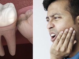 दाढ़ के दर्द से राहत दिलाते हैं कुछ घरेलू नुस्खे, बस इन 3 चीजों को लगाकर रखना होगा दांत पर 