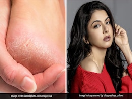 Bhagyashree से जानिए जब एड़ी में हो दर्द तो इन 3 एक्सरसाइज को करके मिल सकती है राहत Bhagyashree से जानिए जब एड़ी में हो दर्द तो इन 3 एक्सरसाइज को करके मिल सकती है राहत