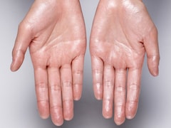 Sweaty Hands? Here's What Your Body Might Be Trying To Tell You