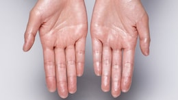 Sweaty Hands? Here's What Your Body Might Be Trying To Tell You
