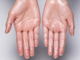 Sweaty Hands? Here's What Your Body Might Be Trying To Tell You
