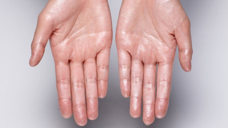 Sweaty Hands? Here's What Your Body Might Be Trying To Tell You
