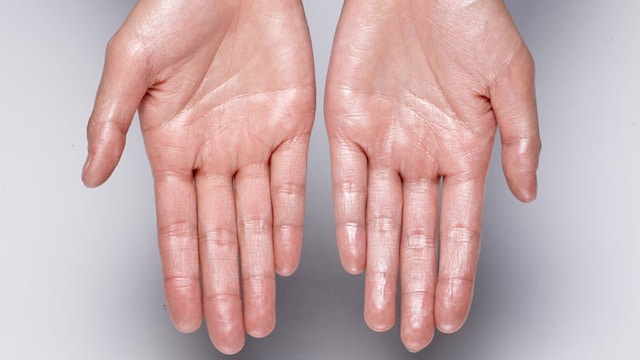 Your palms have a high concentration of sweat glands that respond quickly to emotional triggers.