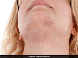 Facial Hair Removal: बस ये 3 तरीके आजमा लीजिए, चेहरे के सारे अनचाहे बाल हो जाएंगे दूर, फेस लगेगा एकदम क्लीन Facial Hair Removal: बस ये 3 तरीके आजमा लीजिए, चेहरे के सारे अनचाहे बाल हो जाएंगे दूर, फेस लगेगा एकदम क्लीन