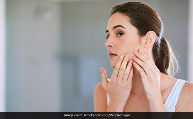 Adult Acne: Causes, Skin Care Tips And Expert-Approved Treatment For Adults With Pimples