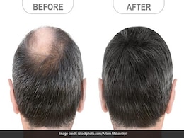 Hair Care Oil : पुरुषों में होती है गंजेपन की समस्या, नानी-दादी के बताएं इन तेलों को लगाएं, फिर उग आएंगे बाल! Hair Care Oil : पुरुषों में होती है गंजेपन की समस्या, नानी-दादी के बताएं इन तेलों को लगाएं, फिर उग आएंगे बाल!