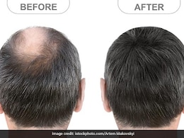 बाल धोने के बाद बालों पर लगा लें इस सफेद चीज का पानी, गंजी खोपड़ी पर भी निकलेंगे नए बाल, कमर तक हो जाएंगे लंबे बाल धोने के बाद बालों पर लगा लें इस सफेद चीज का पानी, गंजी खोपड़ी पर भी निकलेंगे नए बाल, कमर तक हो जाएंगे लंबे